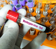 A gloved hand holding a monkypox virus text vial